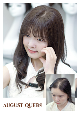 女士假发真实案例